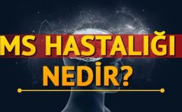 Multiple Skleroz (MS) Hastalığı: Belirtileri